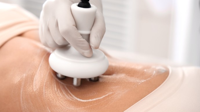 Aparatología Estética en San Isidro Martínez